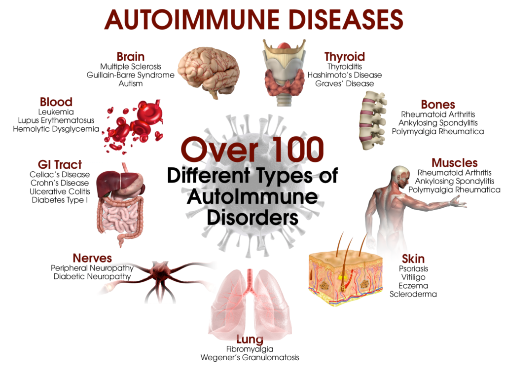 How To Cure Autoimmune Disease Trackreply4 how-to-cure-autoimmune-disease-trackreply4